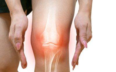 Inflammation: What Are the Causes & How to Reduce It