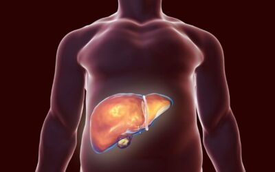 How To Reverse Fatty Liver