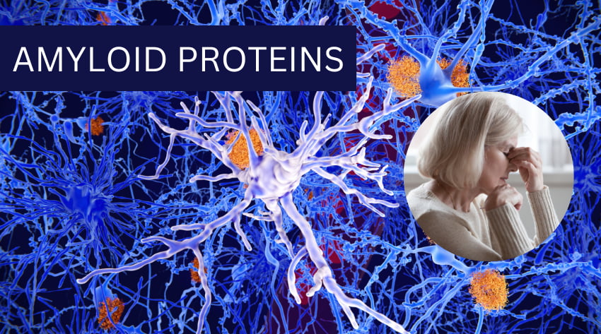 what are amyloid proteins