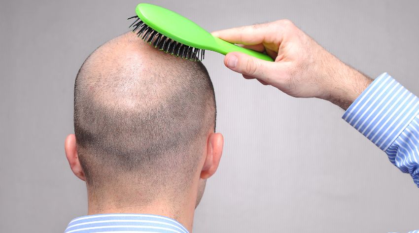 the root cause of hair loss_sara banta health