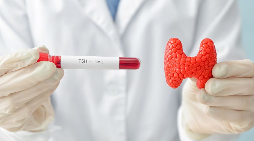 lab technician holding a ash thyroid test tube