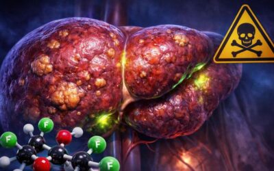 Forever Chemicals Triple Liver Disease Risk